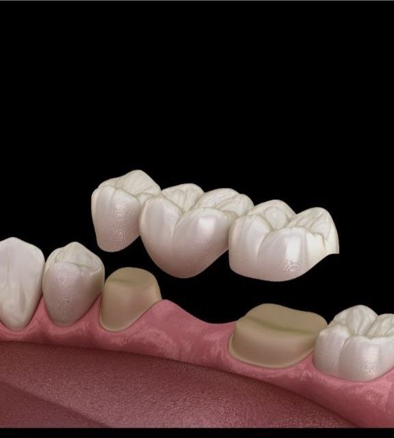Implants & Prosthodontics